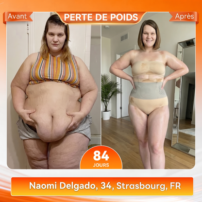 Boutique Officielle de la Marque 💎 𝑪𝑼𝑺𝑰𝑱𝑨𝑺® 2026 Moringa & Berbérine 4-en-1 Micro-Particules Sculptantes & Brûlantes de Graisse Shorts